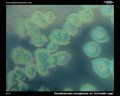 cetrimide agar